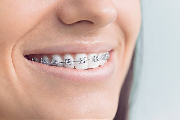 Dental Inlays and Onlays in Mound, MN